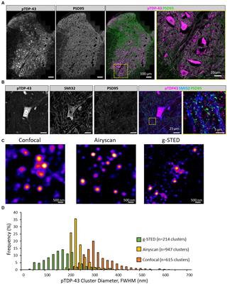 Synaptic expression of TAR-DNA-binding protein 43 in the mouse spinal cord determined using super-resolution microscopy